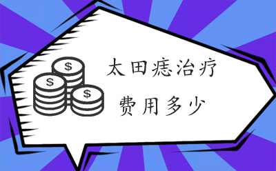 询问太田痣的治疗费用是多少_成都博肤胎记医生解答